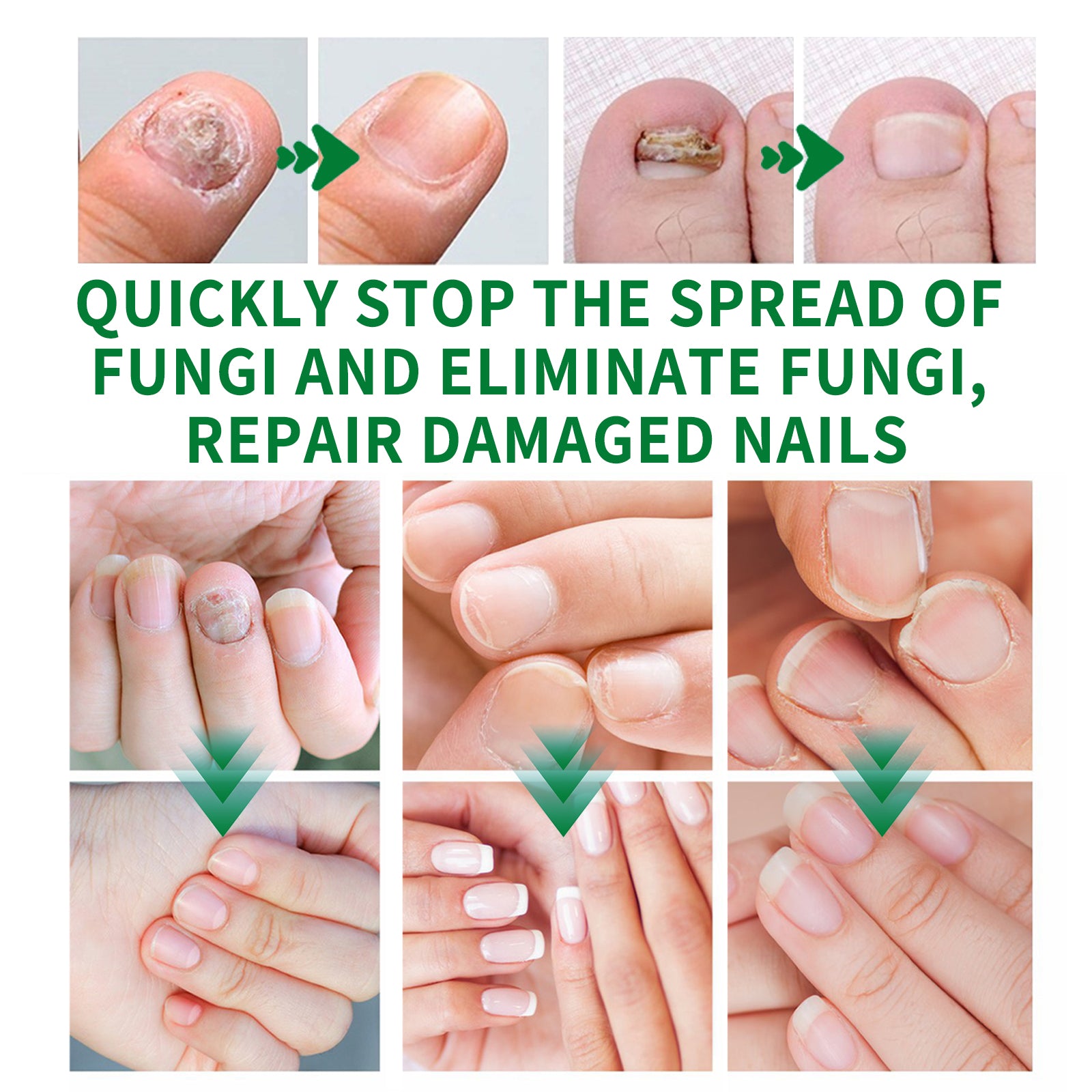 Ginger Nail Treatment |Repair Hand & Foot Nail Care Softens & Brightens Nails Moisturizing Solution-9Y88