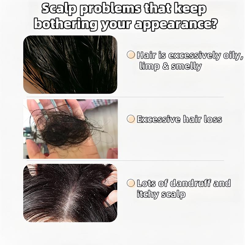 Anti-Hair Fall Hair -KY