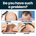 Hair Strengthening & Thickening Nourishing Serum-3LY