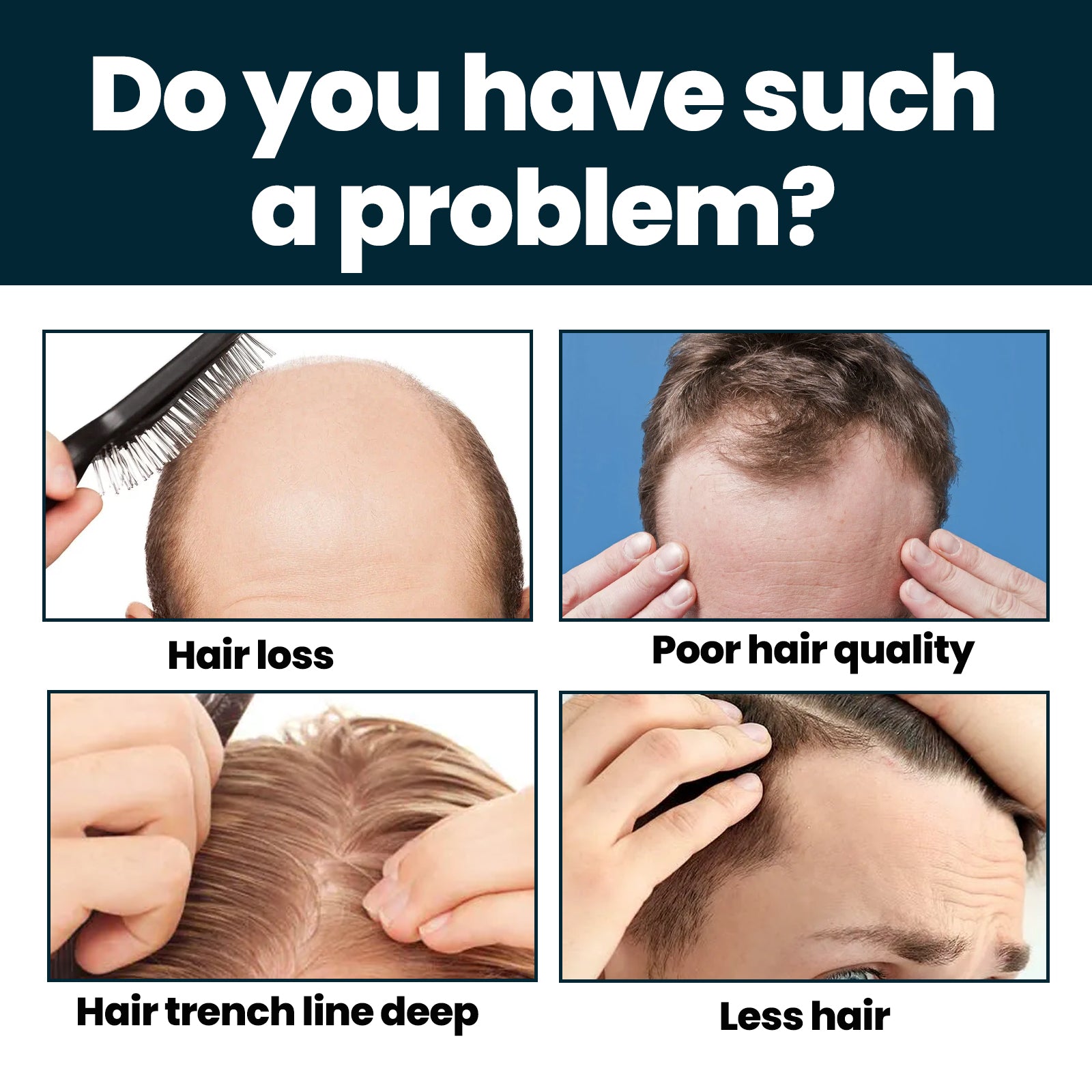 Hair Strengthening & Thickening Nourishing Serum-3LY