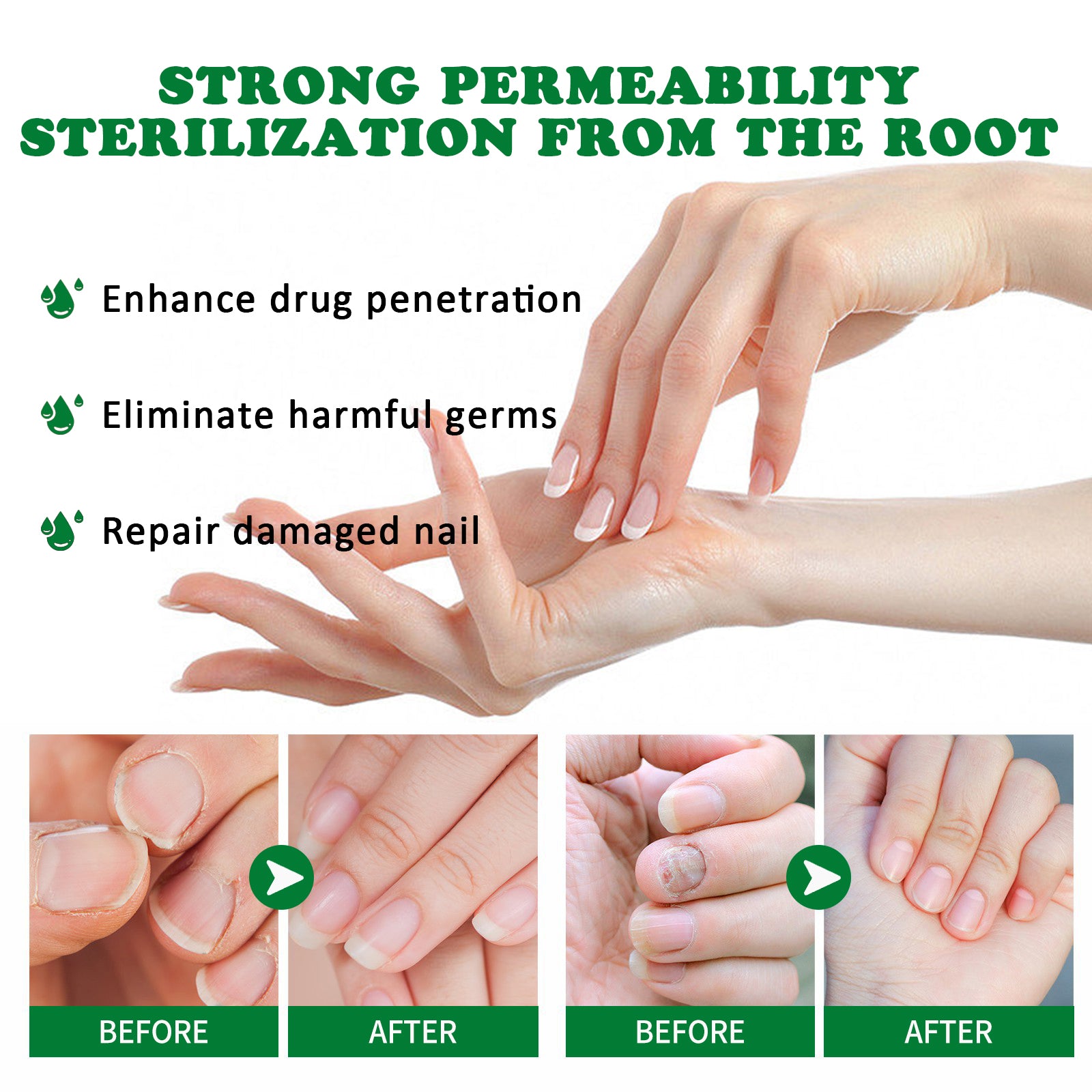 Ginger Nail Treatment |Repair Hand & Foot Nail Care Softens & Brightens Nails Moisturizing Solution-9Y88